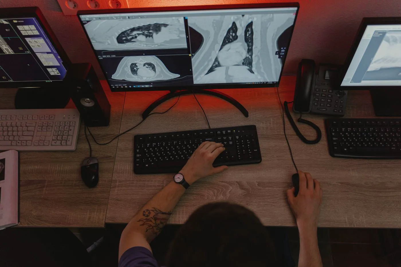 Radiologist reading a set of scans across multiple diagnostic monitors