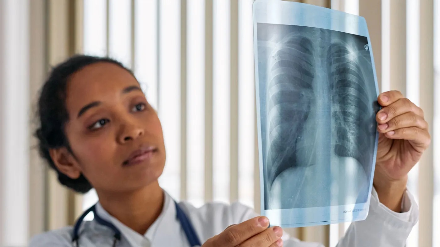 A doctor holding up a chest X-ray to the light and studying it closely