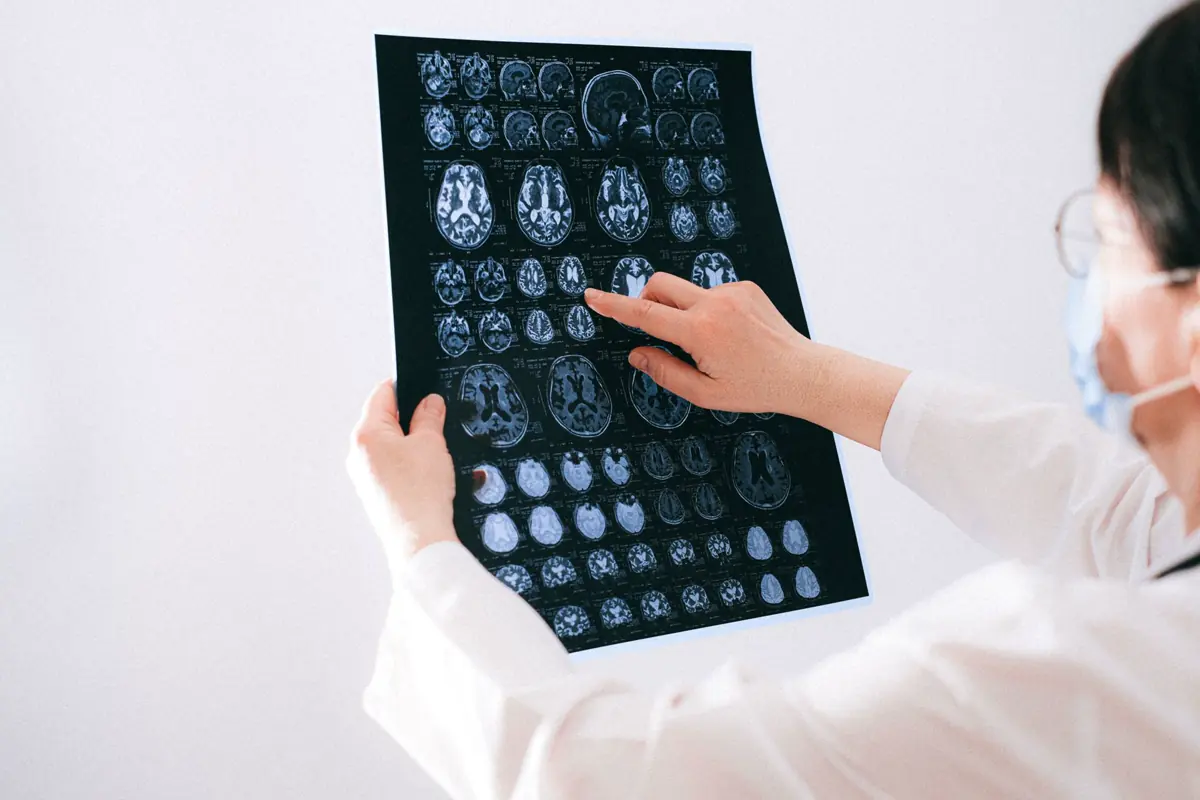 A doctor examining brain MRI scans on a lightbox