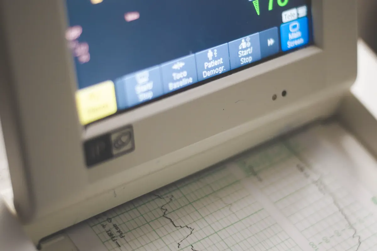 An ECG monitor displaying heart rate and pulse data